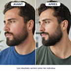 Crème anti-squames — barbe et peau