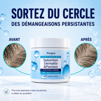 Crème anti-squames — barbe et peau