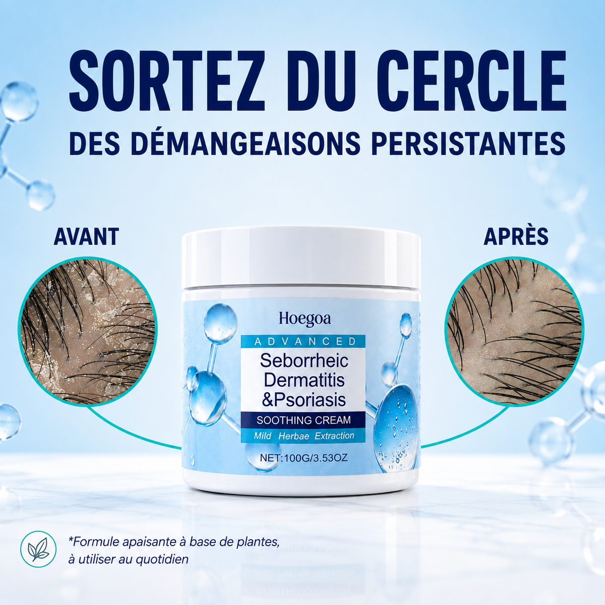 Crème anti-squames — barbe et peau